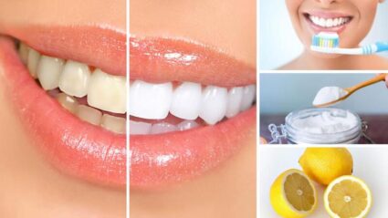 cách làm trắng răng tại nhà