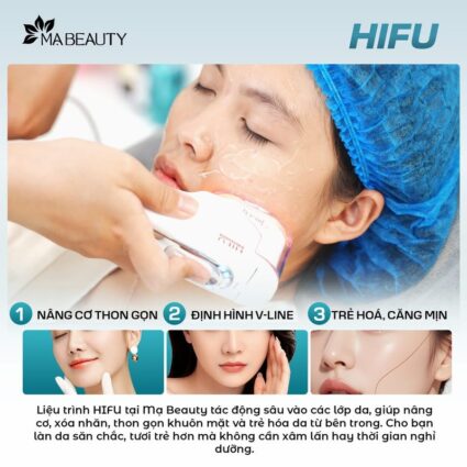 nâng cơ hifu tại mạ beauty